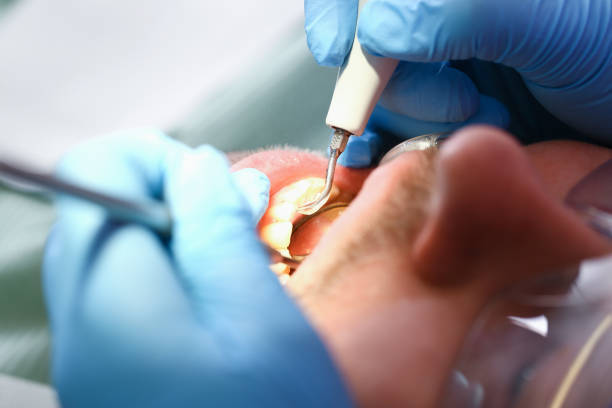 Best After-Hours Emergency Dentist in Plafield, IN