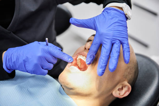 Best Emergency Broken Tooth Repair in Plafield, IN